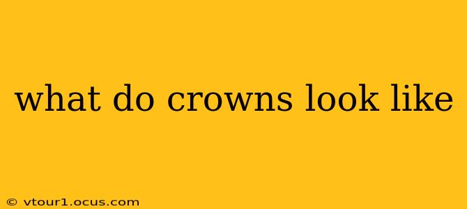 what do crowns look like