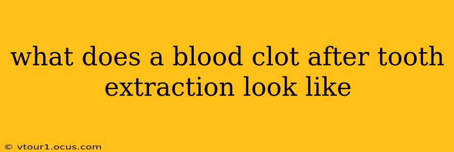 what does a blood clot after tooth extraction look like