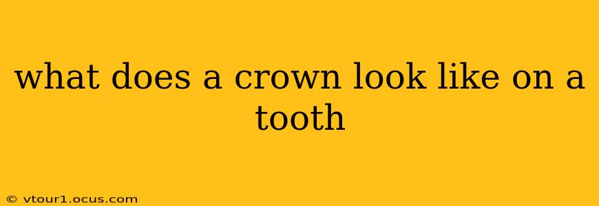 what does a crown look like on a tooth