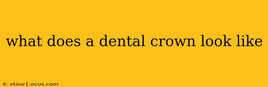 what does a dental crown look like