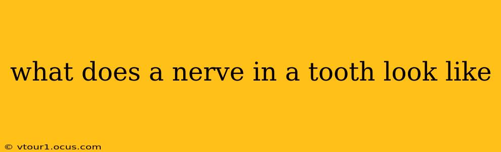 what does a nerve in a tooth look like
