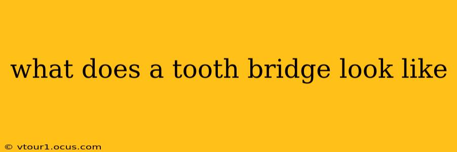 what does a tooth bridge look like
