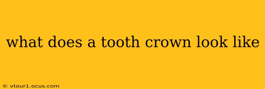 what does a tooth crown look like