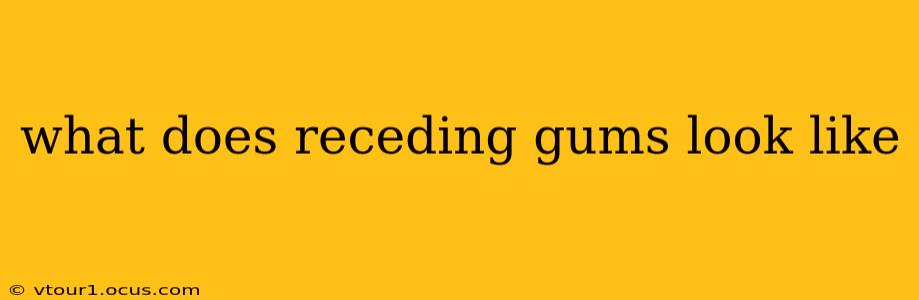 what does receding gums look like