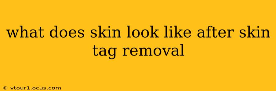 what does skin look like after skin tag removal