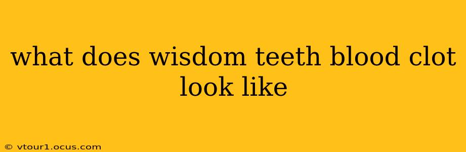 what does wisdom teeth blood clot look like