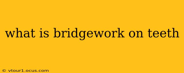 what is bridgework on teeth