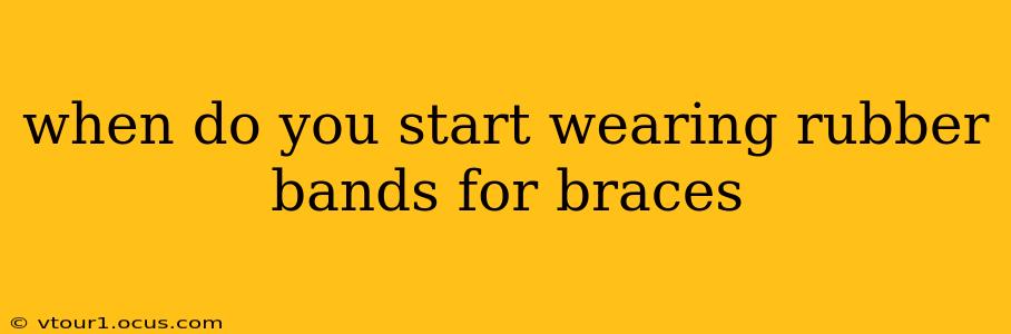 when do you start wearing rubber bands for braces