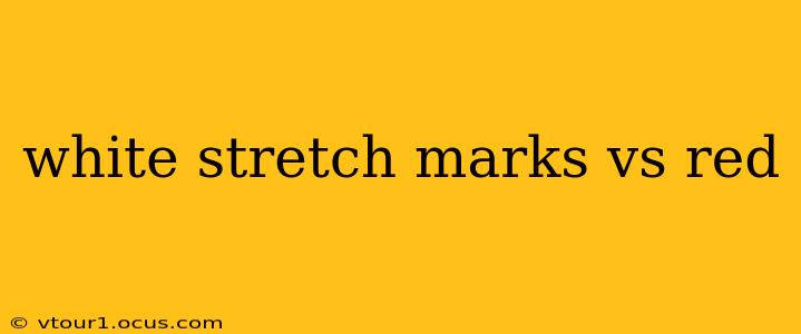 white stretch marks vs red