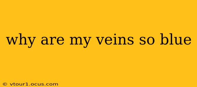 why are my veins so blue