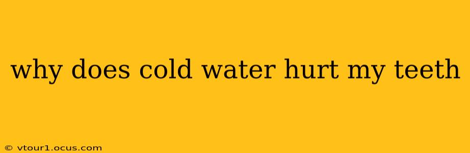 why does cold water hurt my teeth