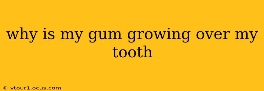 why is my gum growing over my tooth