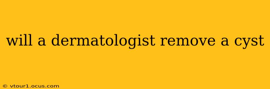 will a dermatologist remove a cyst
