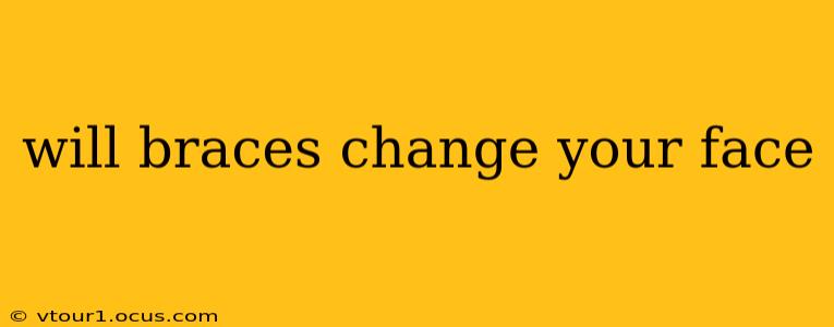 will braces change your face