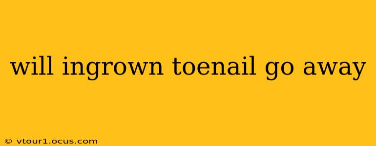 will ingrown toenail go away