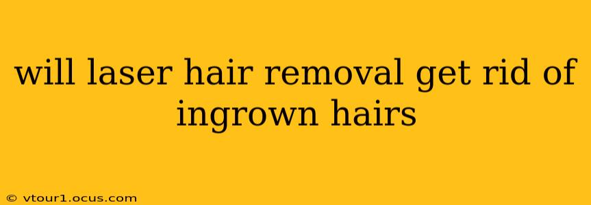 will laser hair removal get rid of ingrown hairs