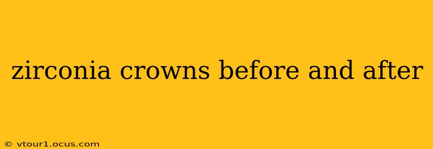 zirconia crowns before and after